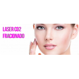 quanto custa tratamento de pele com laser Vila Andrade