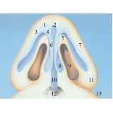 rinoplastia para homens Santo Amaro