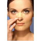 rinoplastia para levantar a ponta do nariz preço Santo Amaro