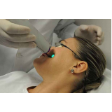 tratamento de pele a laser co2 Morumbi