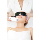 tratamento de pele a laser Morumbi