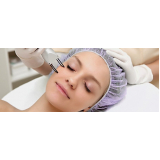 tratamento de pele laser co2 fracionado Santo Amaro