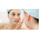 tratamento de pele para manchas valor Taboão da Serra
