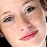 tratamento de pele para tirar manchas preço Santo Amaro