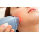 tratamento para pele a laser Taboão da Serra