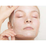 tratamento para pele do rosto valor Vila Andrade