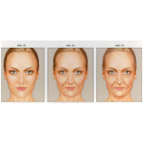 tratamento para pele envelhecida preço Santo Amaro