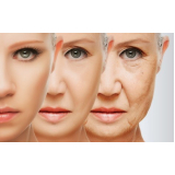 tratamento para pele envelhecida valor Morumbi