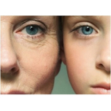 tratamento para pele envelhecida São Paulo