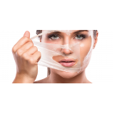 Tratamento de Pele a Laser